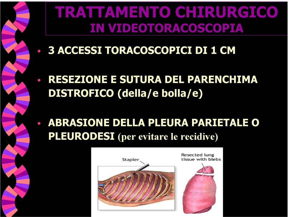 PARENCHIMA DISTROFICO (della/e bolla/e) ABRASIONE