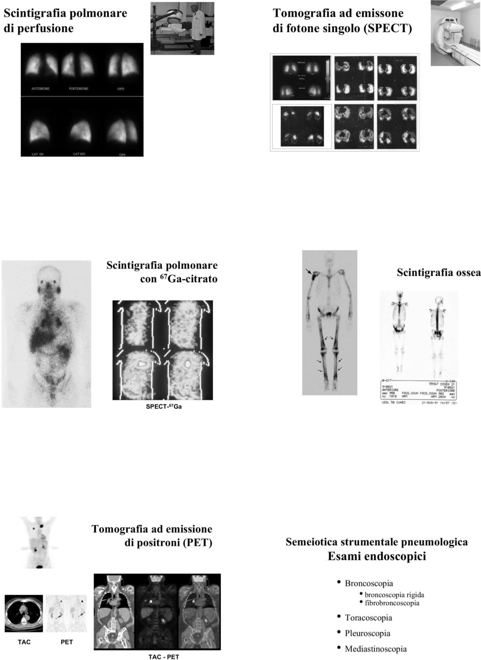 emissione di positroni (PET) Semeiotica strumentale pneumologica Esami endoscopici TAC PET