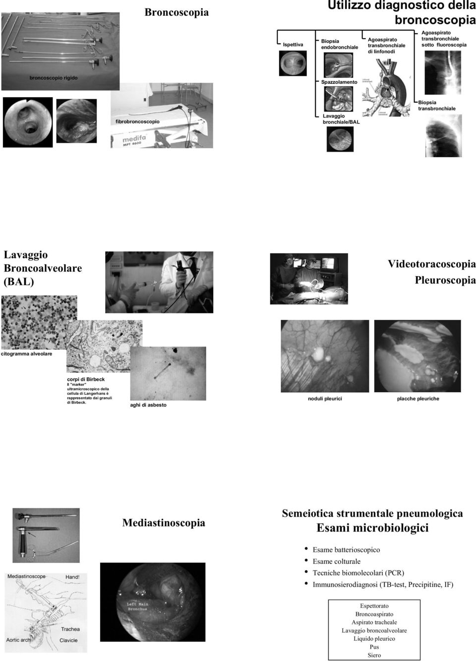 ultramicroscopico della cellula di Langerhans è rappresentato dai granuli di Birbeck.