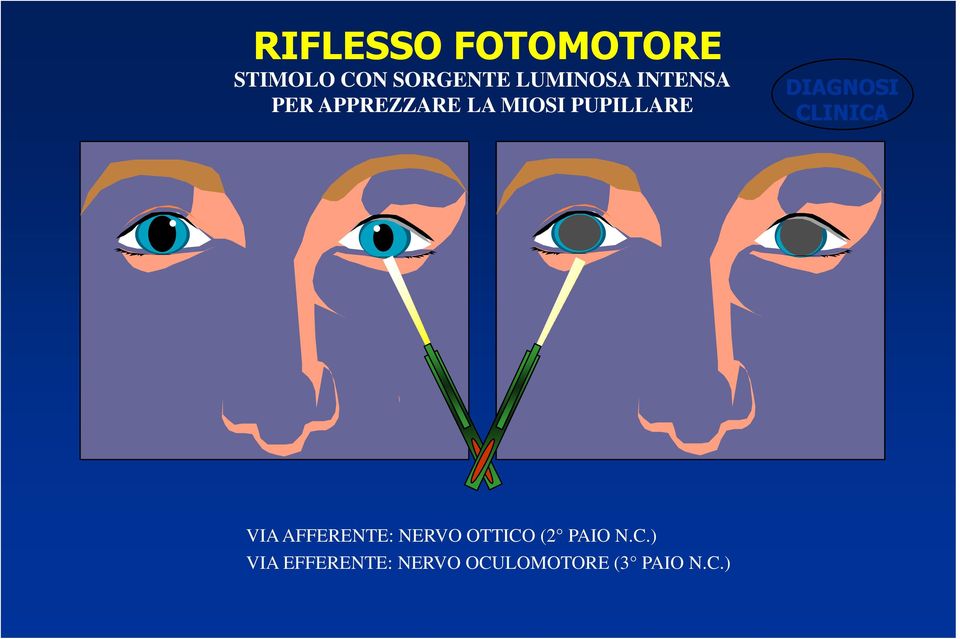 DIAGNOSI CLINICA VIA AFFERENTE: NERVO OTTICO (2