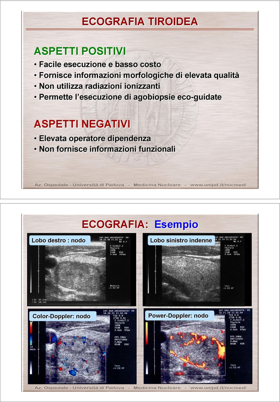 agobiopsie eco-guidate ASPETTI NEGATIVI Elevata operatore dipendenza Non fornisce informazioni