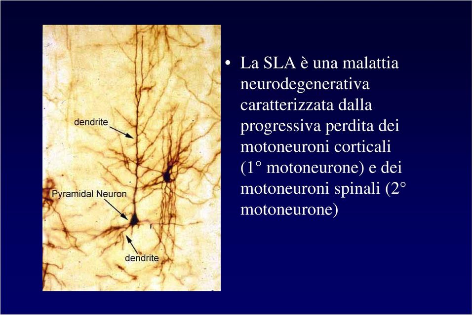dei motoneuroni corticali (1