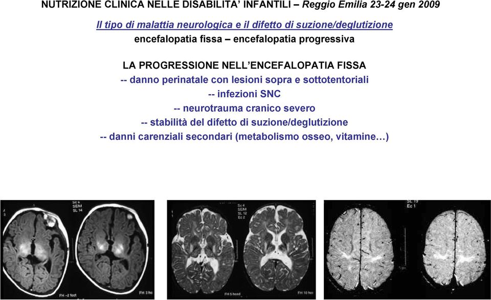 neurotrauma cranico severo -- stabilità del difetto di