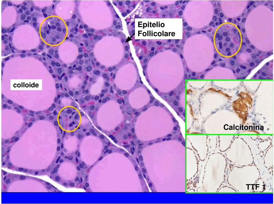 colloide