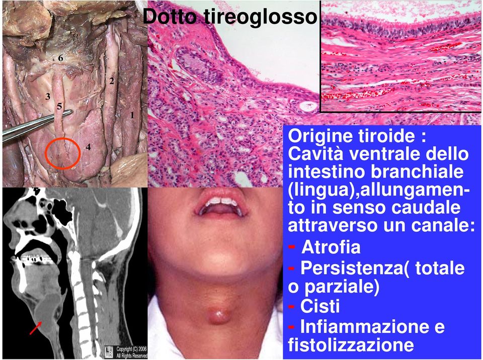 senso caudale attraverso un canale: - Atrofia -