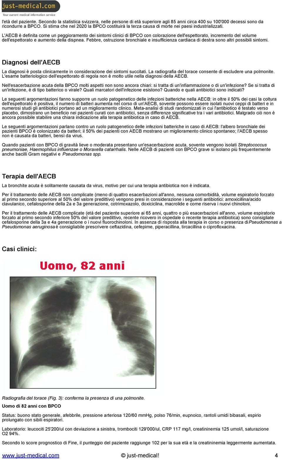 L'AECB è definita come un peggioramento dei sintomi clinici di BPCO con colorazione dell'espettorato, incremento del volume dell'espettorato e aumento della dispnea.