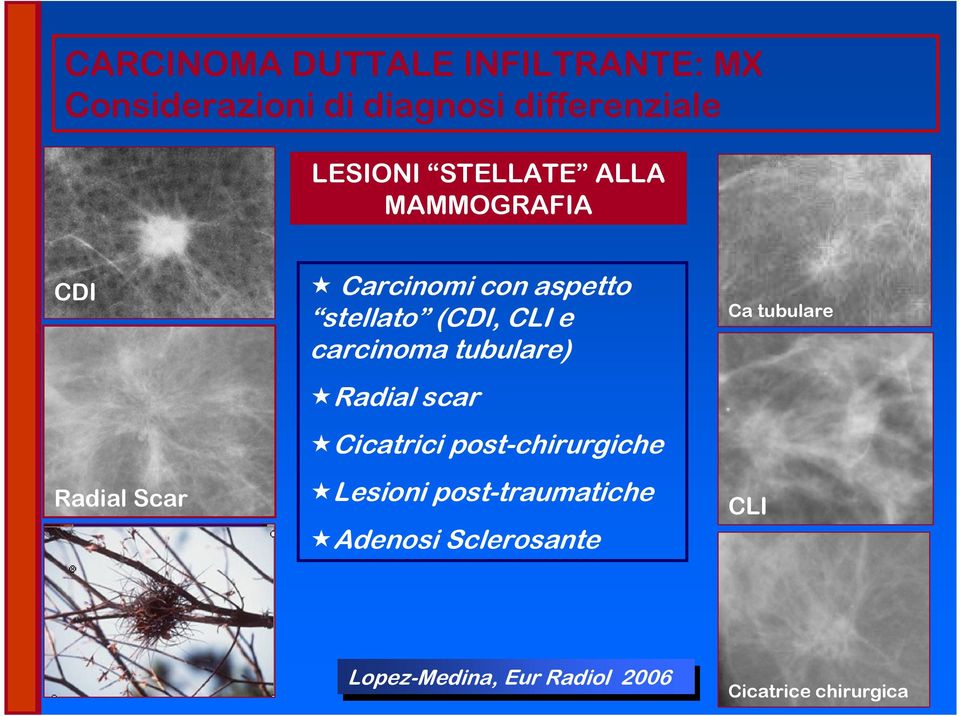 carcinoma tubulare) Radial scar Cicatrici post-chirurgiche Lesioni post-traumatiche