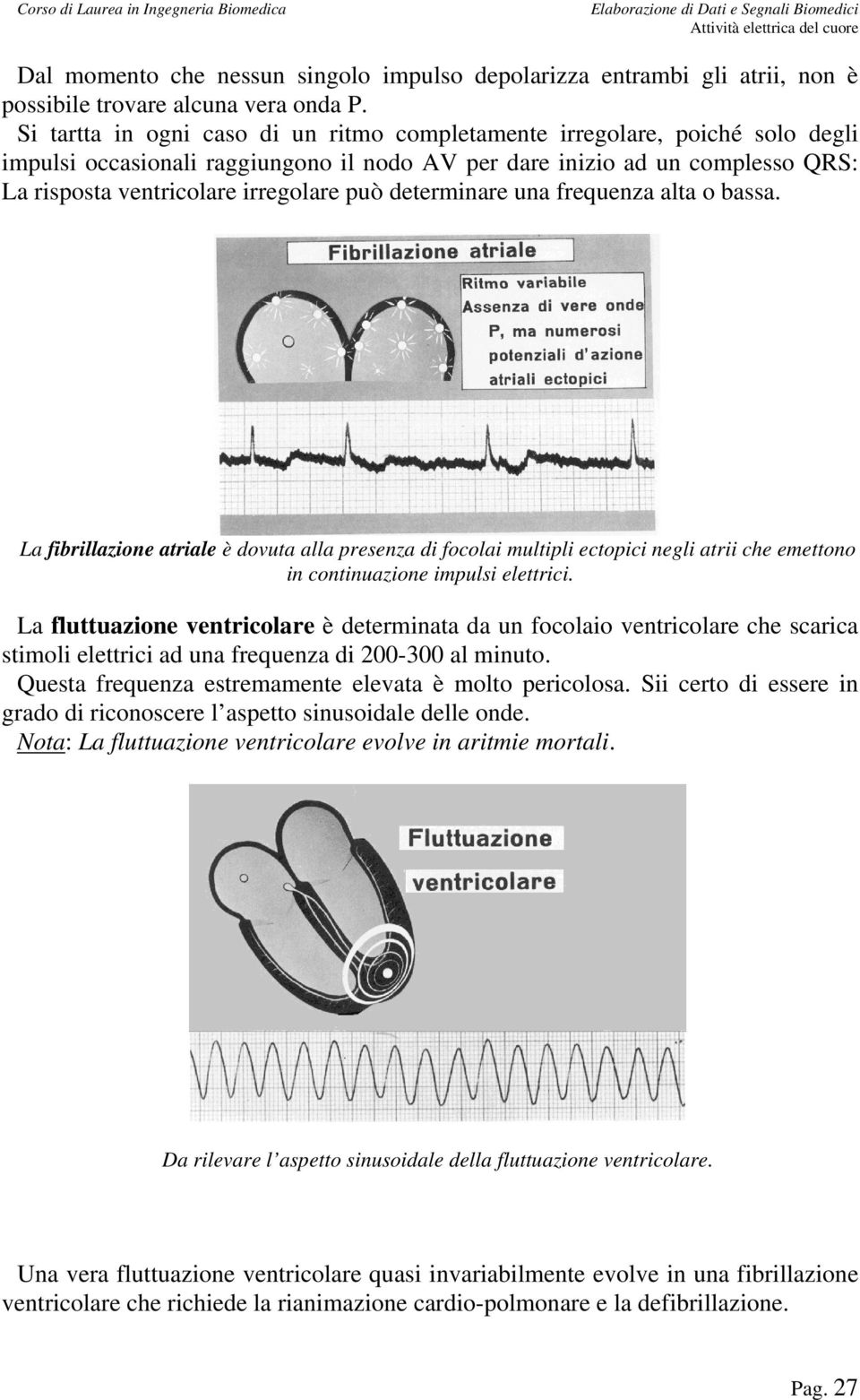 determinare una frequenza alta o bassa. La fibrillazione atriale è dovuta alla presenza di focolai multipli ectopici negli atrii che emettono in continuazione impulsi elettrici.