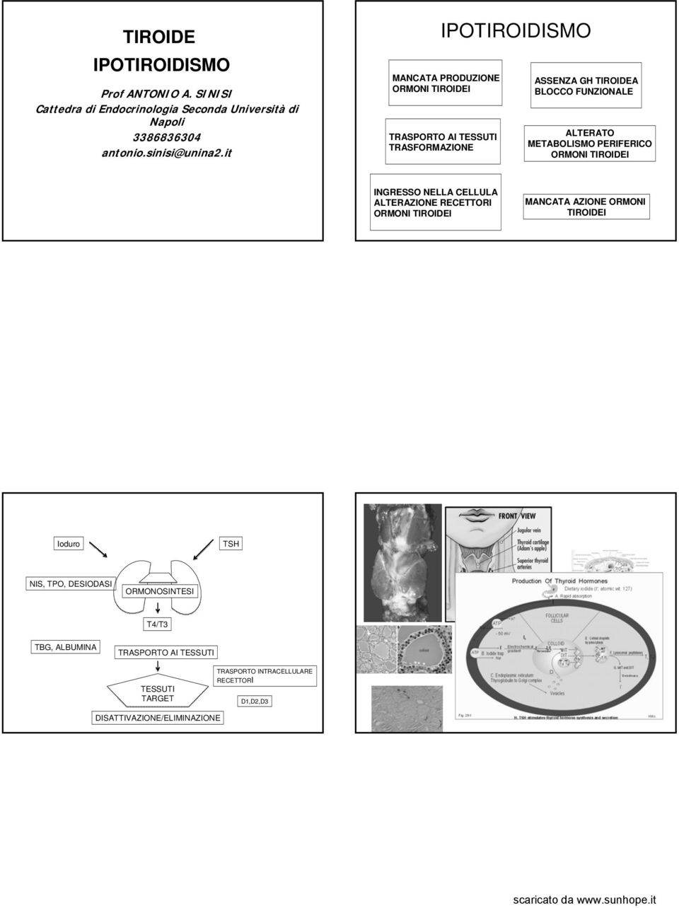 METABOLISMO PERIFERICO ORMONI TIROIDEI INGRESSO NELLA CELLULA ALTERAZIONE RECETTORI ORMONI TIROIDEI MANCATA AZIONE ORMONI TIROIDEI Ioduro TSH