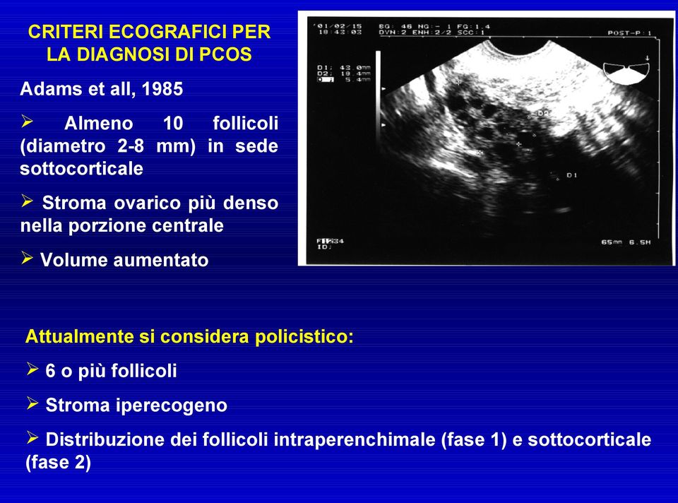 centrale Volume aumentato Attualmente si considera policistico: 6 o più follicoli