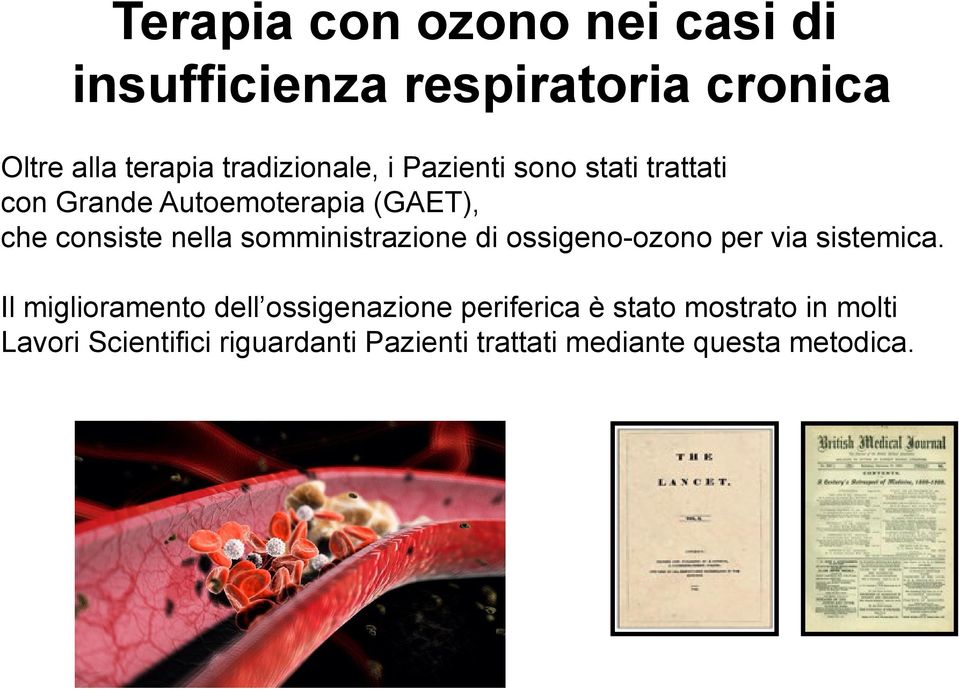 nella somministrazione di ossigeno-ozono per via sistemica.