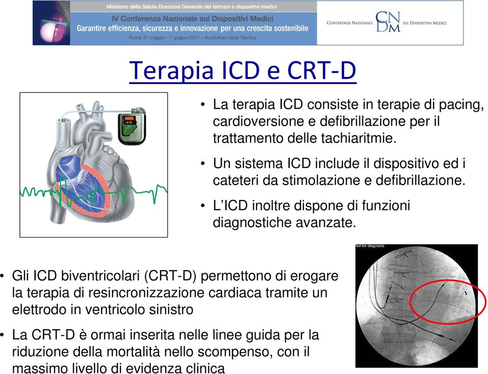 L ICD inoltre dispone di funzioni diagnostiche avanzate.