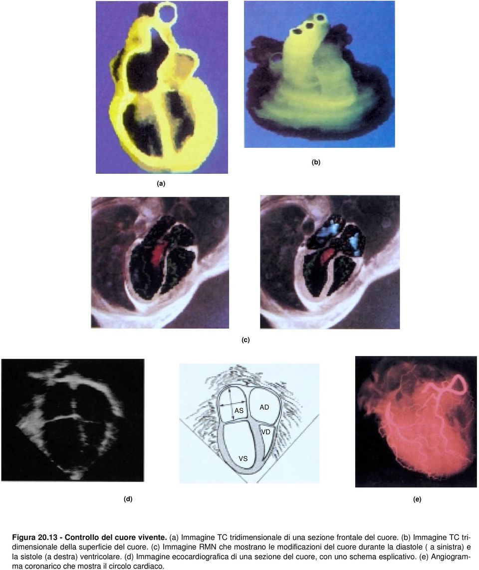 (b) Immagine TC tridimensionale della superficie del cuore.