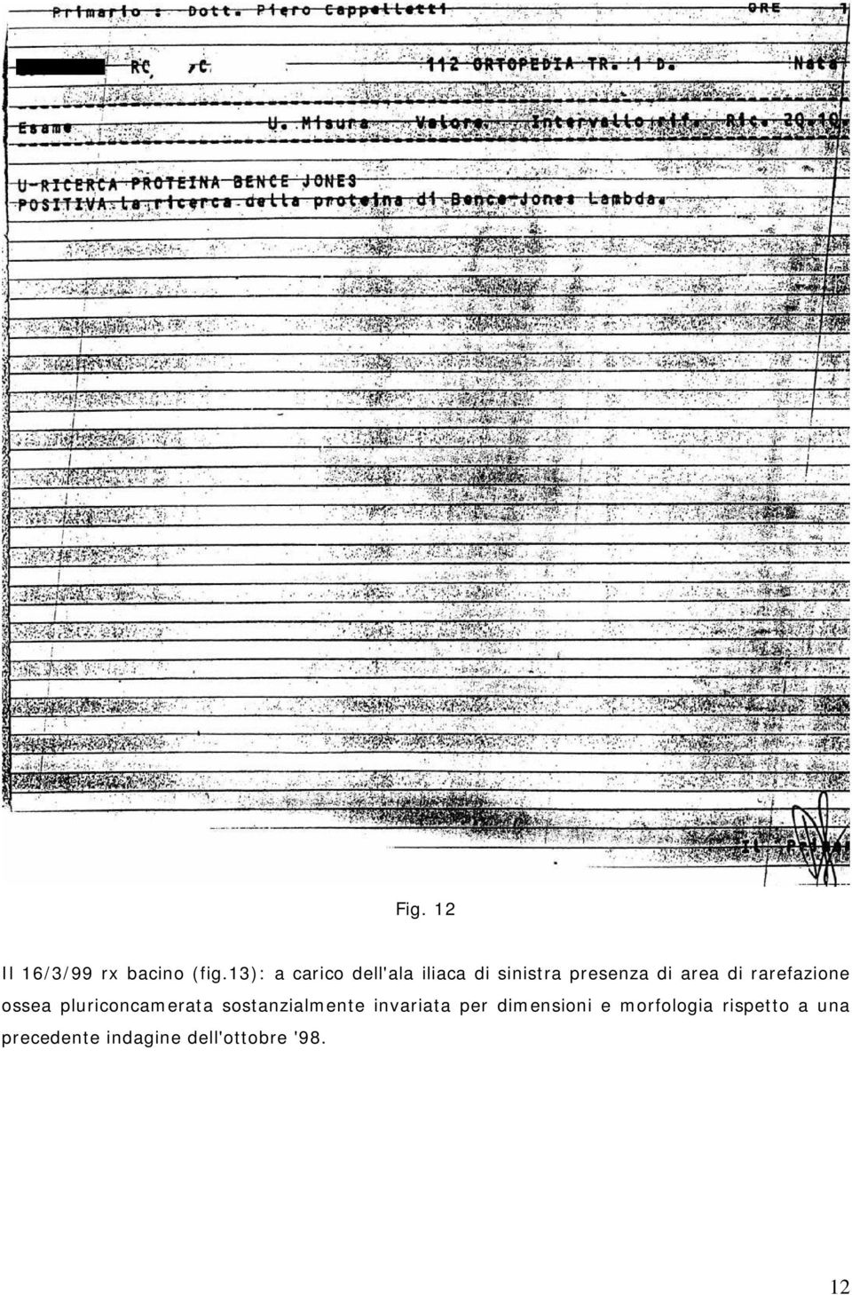 di rarefazione ossea pluriconcamerata sostanzialmente