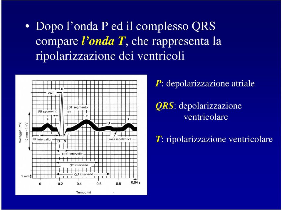 ventricoli P: depolarizzazione atriale QRS: