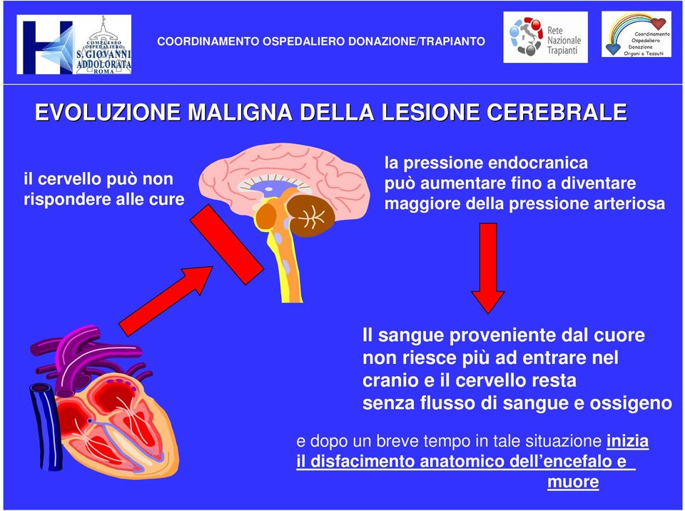 proveniente dal cuore non riesce più ad entrare nel cranio e il cervello resta senza flusso di