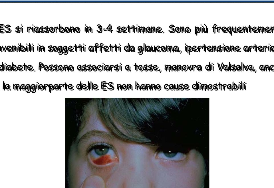 glaucoma, ipertensione arterio iabete.