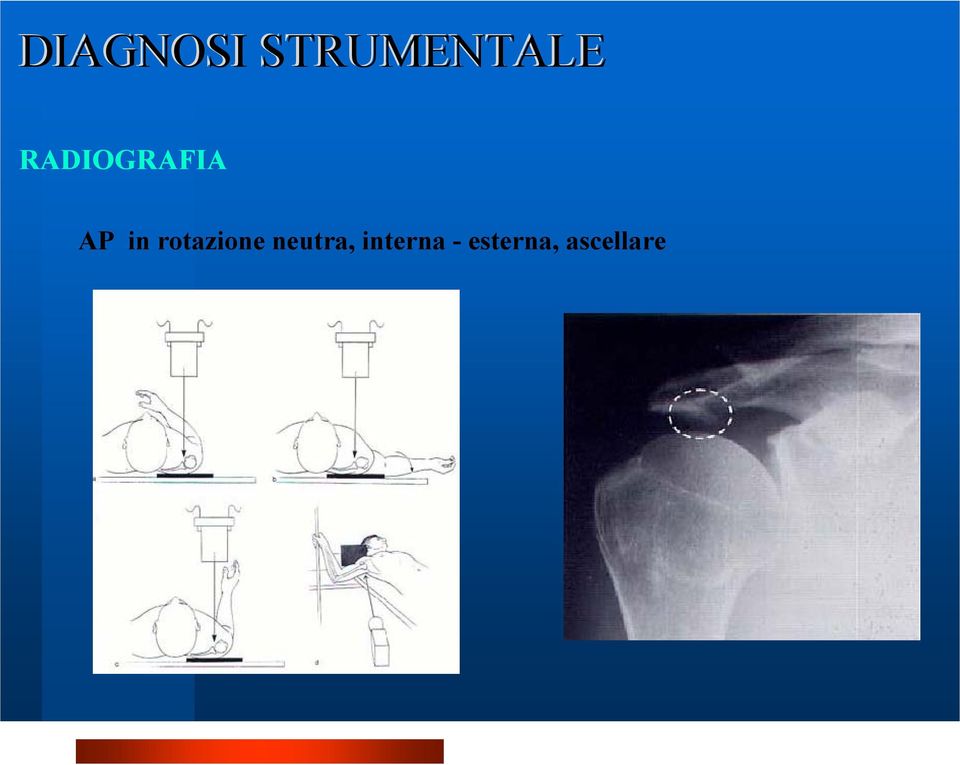 rotazione neutra, interna