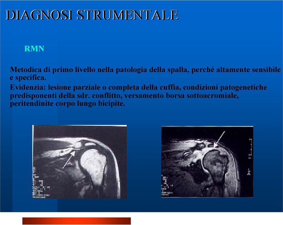 Evidenzia: lesione parziale o completa della cuffia, condizioni patogenetiche