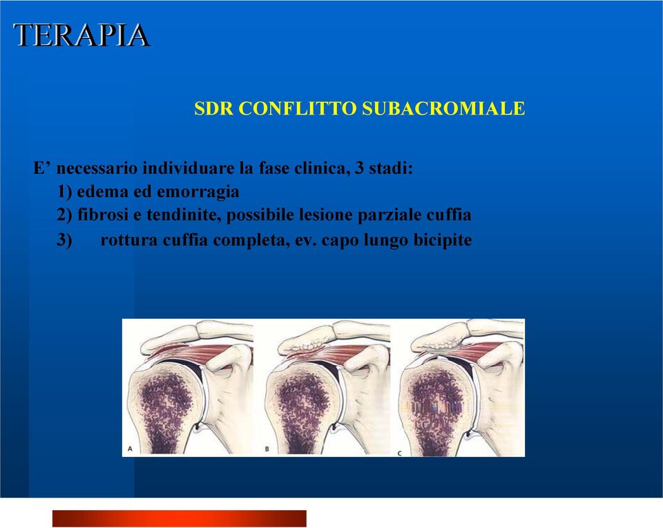 emorragia 2) fibrosi e tendinite, possibile lesione