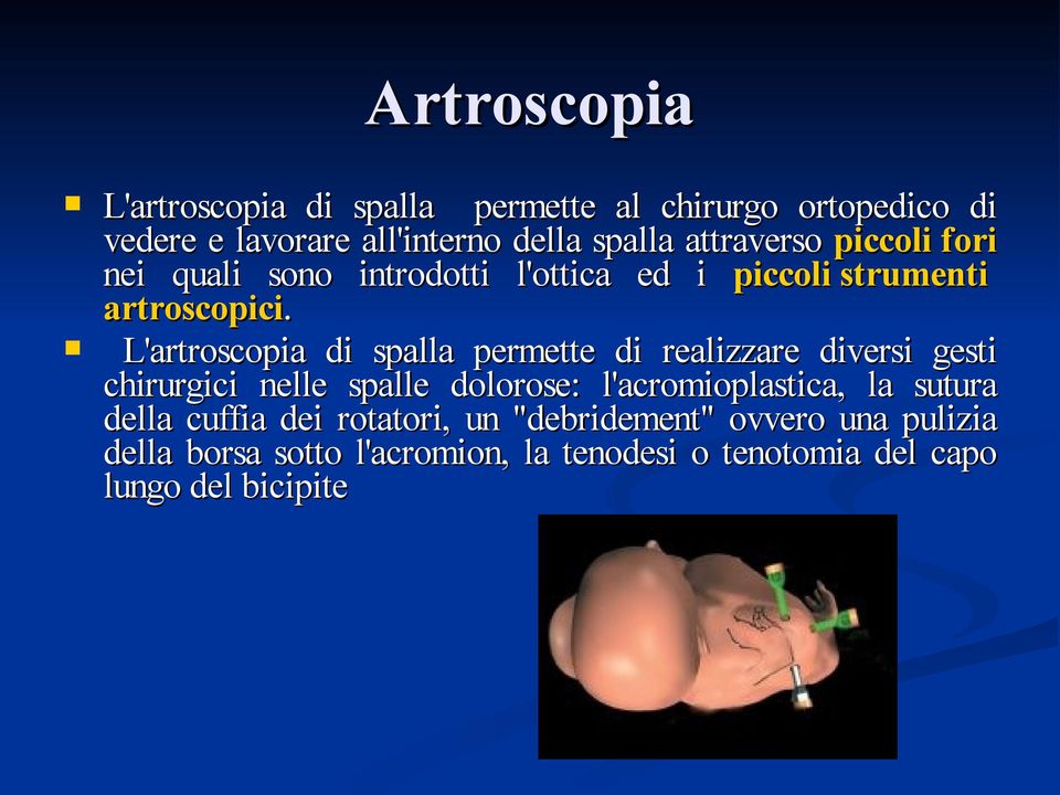 L'artroscopia di spalla permette di realizzare diversi gesti chirurgici nelle spalle dolorose: l'acromioplastica, la