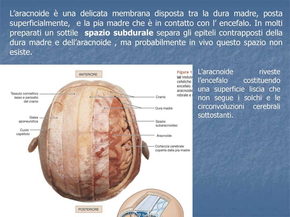 In molti preparati un sottile spazio subdurale separa gli epiteli contrapposti della dura madre e dell