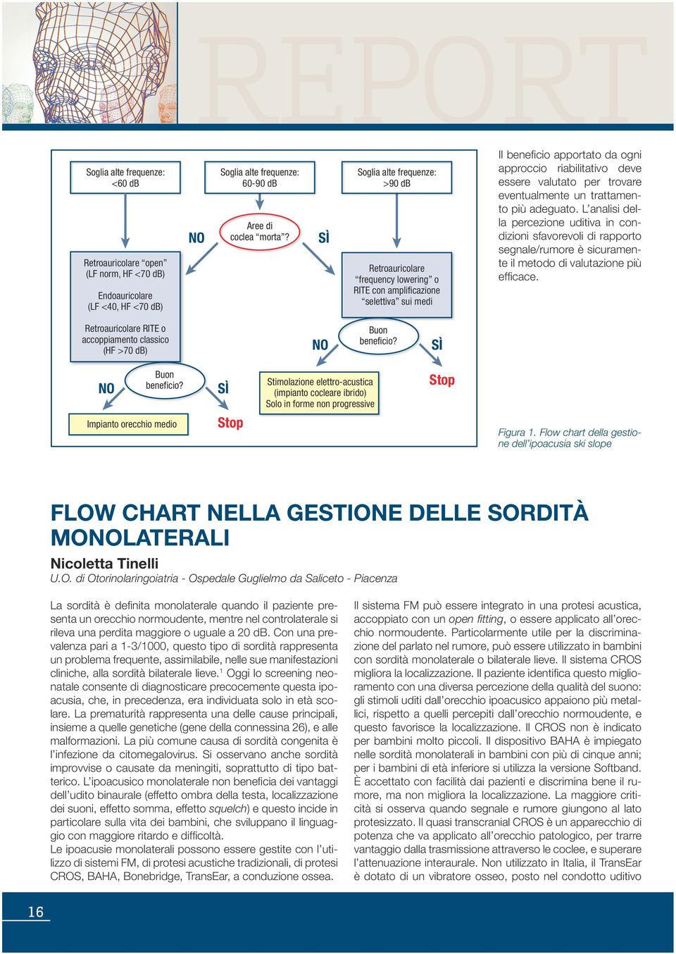 trovare eventualmente un trattamento più adeguato. L analisi della percezione uditiva in condizioni sfavorevoli di rapporto segnale/rumore è sicuramente il metodo di valutazione più efficace.