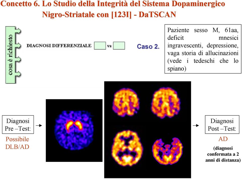 depressione, vaga storia di allucinazioni (vede i tedeschi