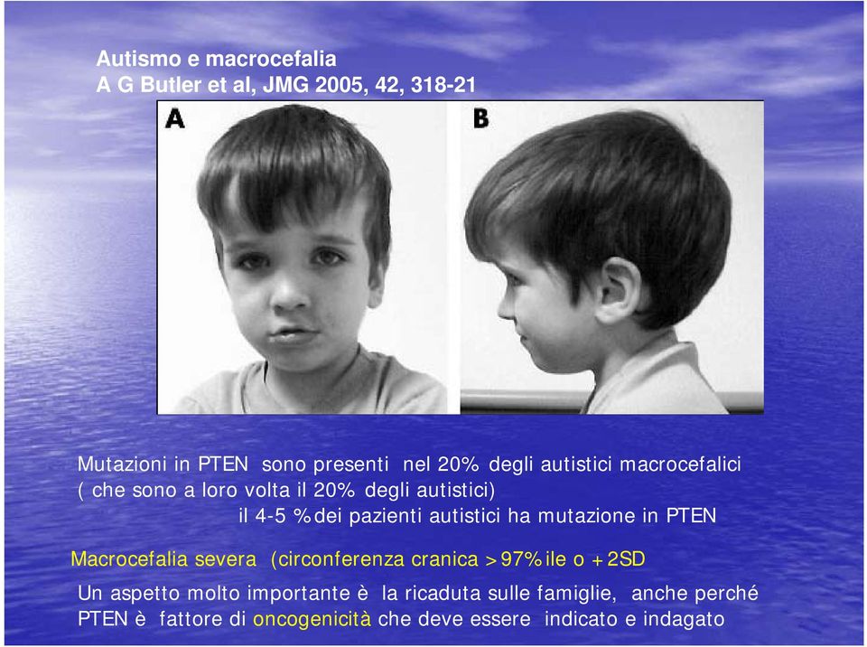 autistici ha mutazione in PTEN Macrocefalia severa (circonferenza cranica >97%ile o +2SD Un aspetto molto