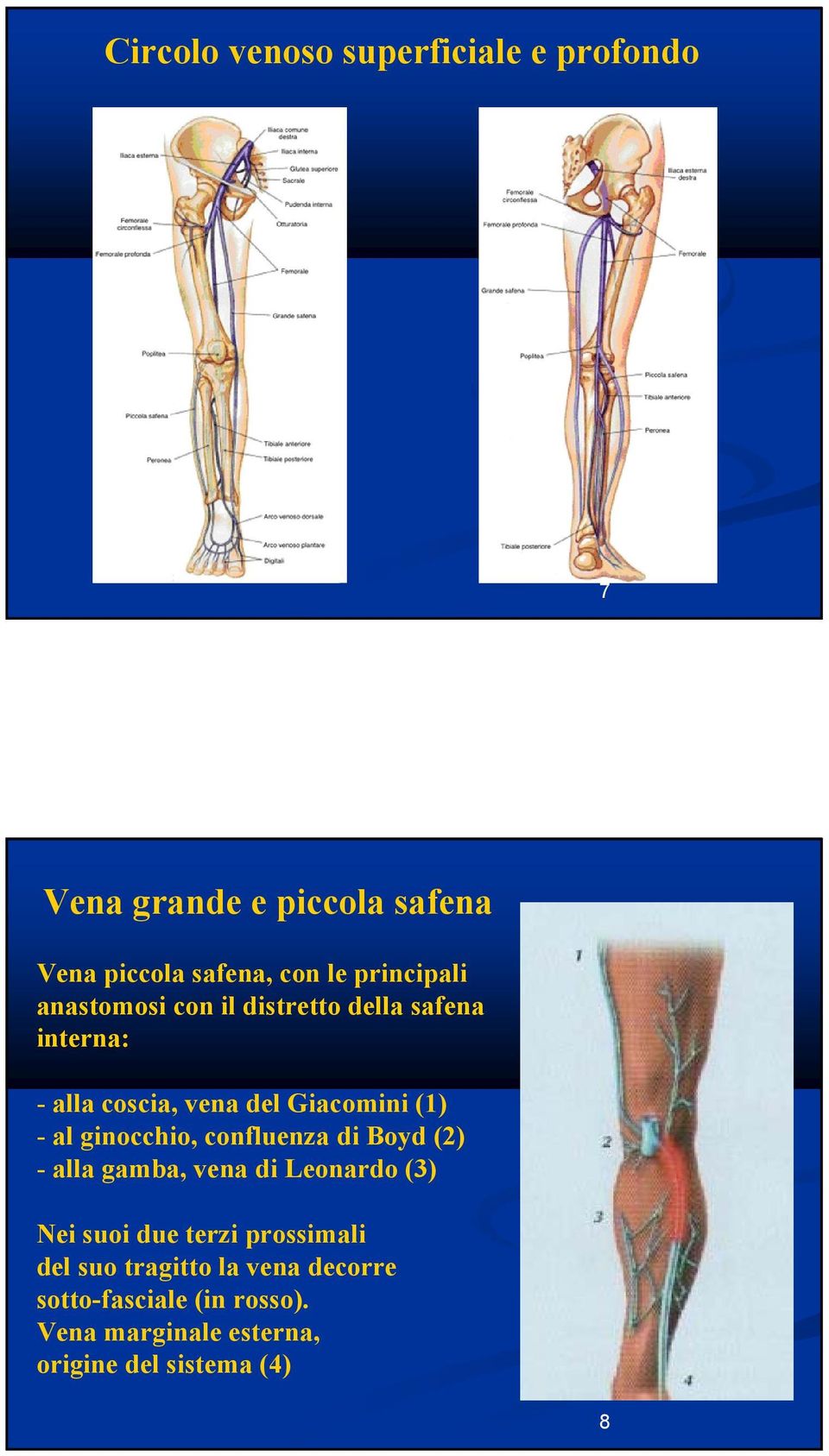 al ginocchio, confluenza di Boyd (2) - alla gamba, vena di Leonardo (3) Nei suoi due terzi prossimali