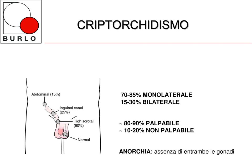 80-90% PALPABILE ~ 10-20% NON