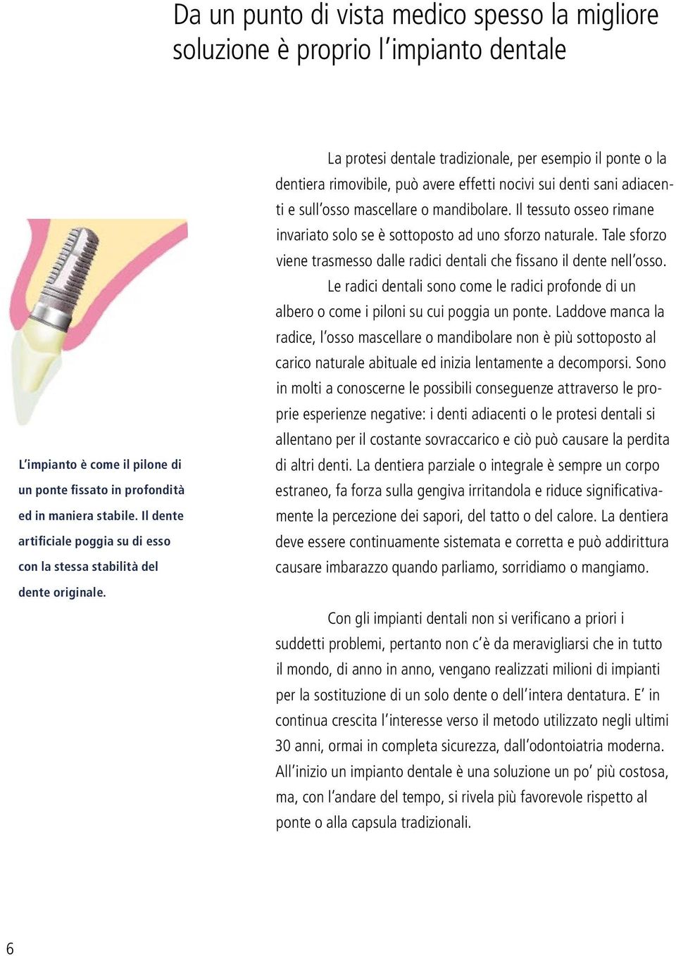 La protesi dentale tradizionale, per esempio il ponte o la dentiera rimovibile, può avere effetti nocivi sui denti sani adiacenti e sull osso mascellare o mandibolare.