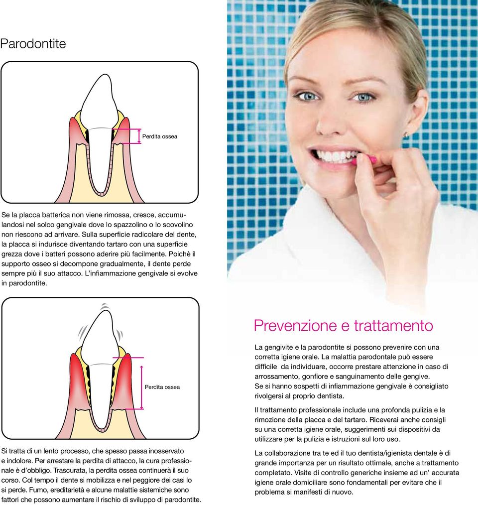 Poichè il supporto osseo si decompone gradualmente, il dente perde sempre più il suo attacco. L infiammazione gengivale si evolve in parodontite.