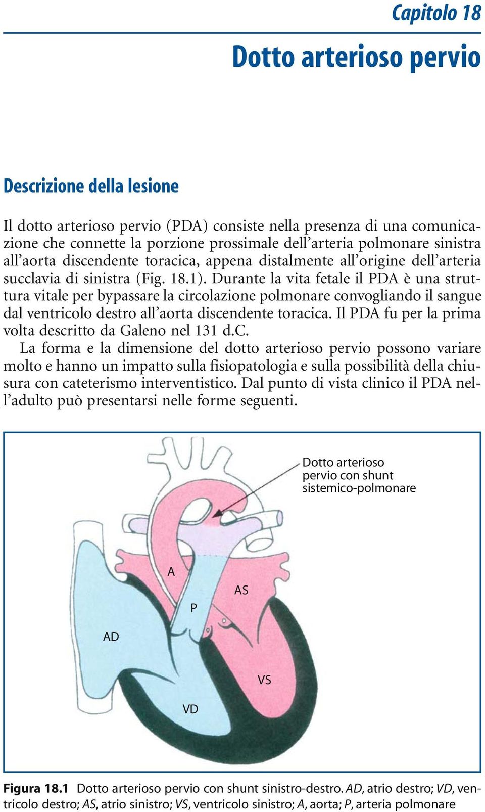 Durante la vita fetale il PDA è una struttura vitale per bypassare la circolazione polmonare convogliando il sangue dal ventricolo destro all aorta discendente toracica.