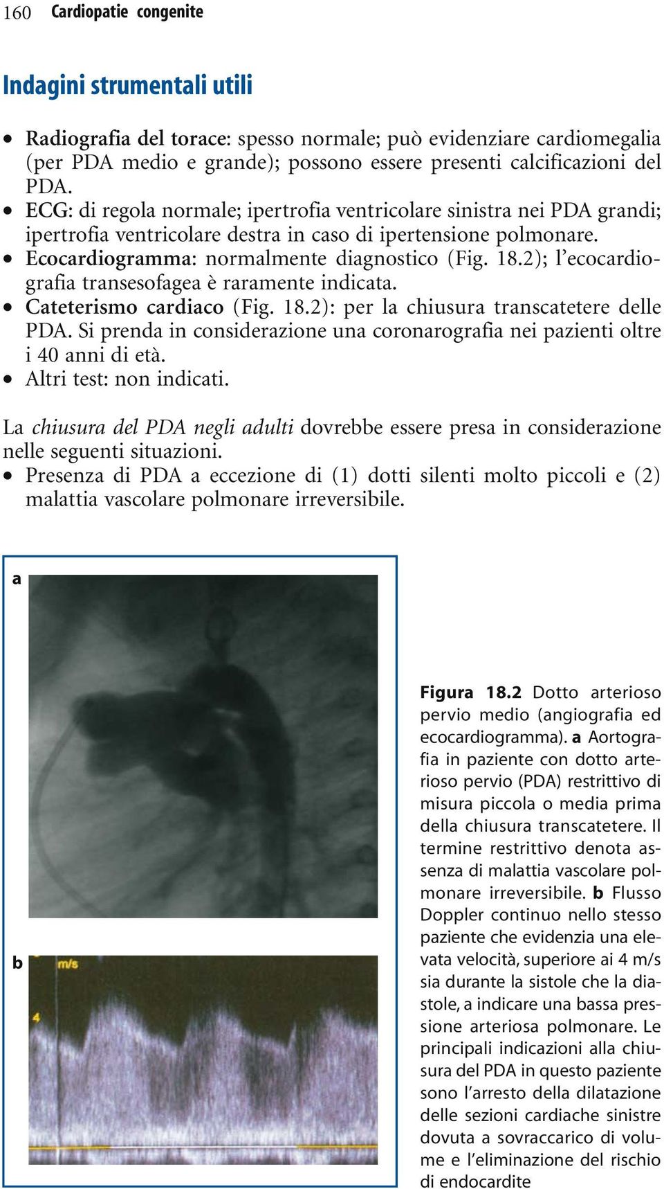2); l ecocardiografia transesofagea è raramente indicata. Cateterismo cardiaco (Fig. 18.2): per la chiusura transcatetere delle PDA.