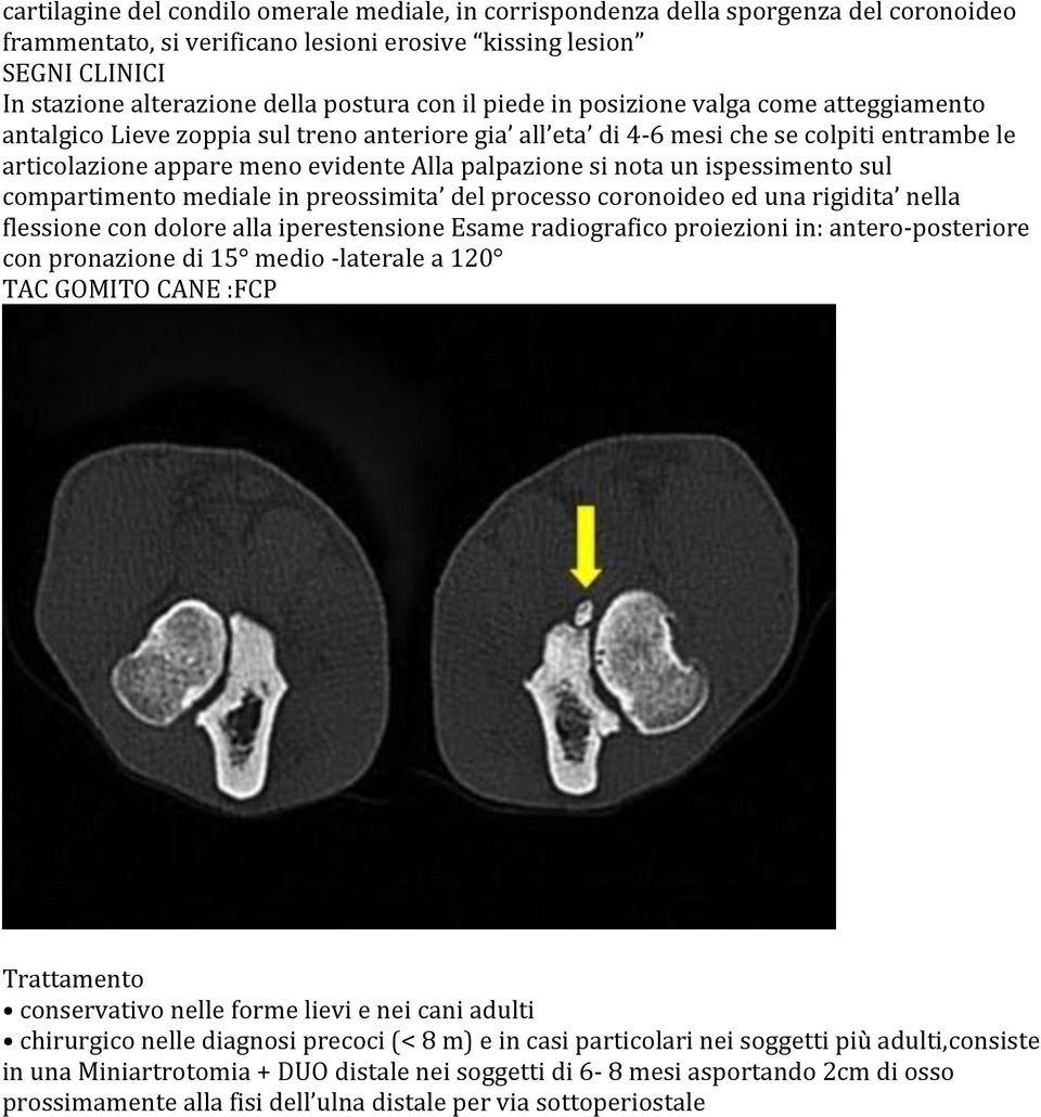 nota un ispessimento sul compartimento mediale in preossimita del processo coronoideo ed una rigidita nella flessione con dolore alla iperestensione Esame radiografico proiezioni in: antero-