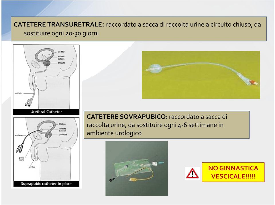 SOVRAPUBICO: raccordato a sacca di raccolta urine, da