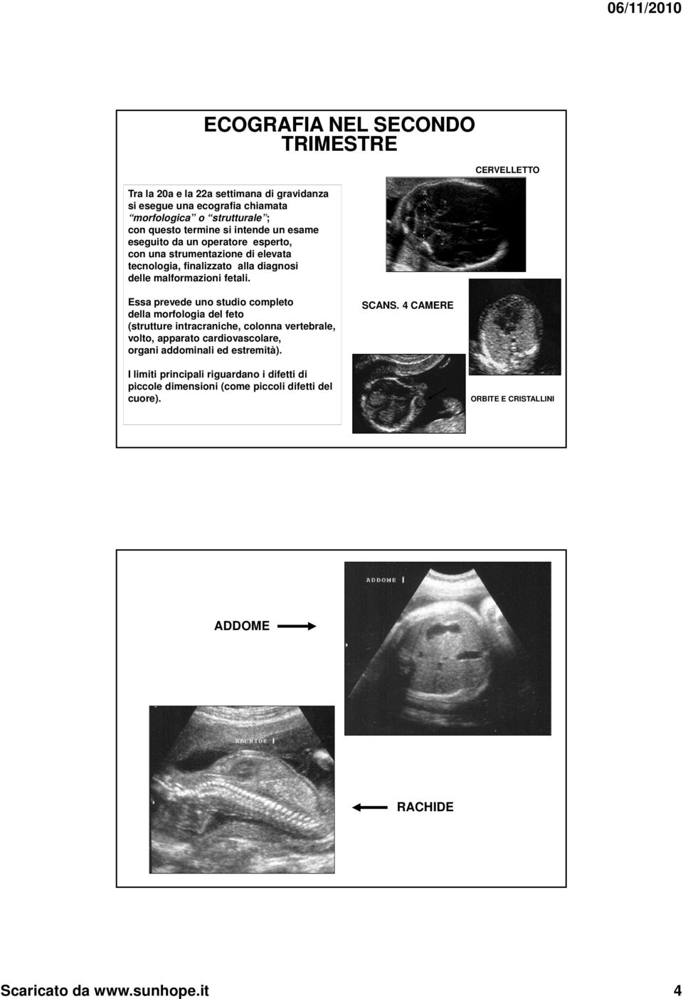 Essa prevede uno studio completo della morfologia del feto (strutture intracraniche, colonna vertebrale, volto, apparato cardiovascolare, organi addominali ed