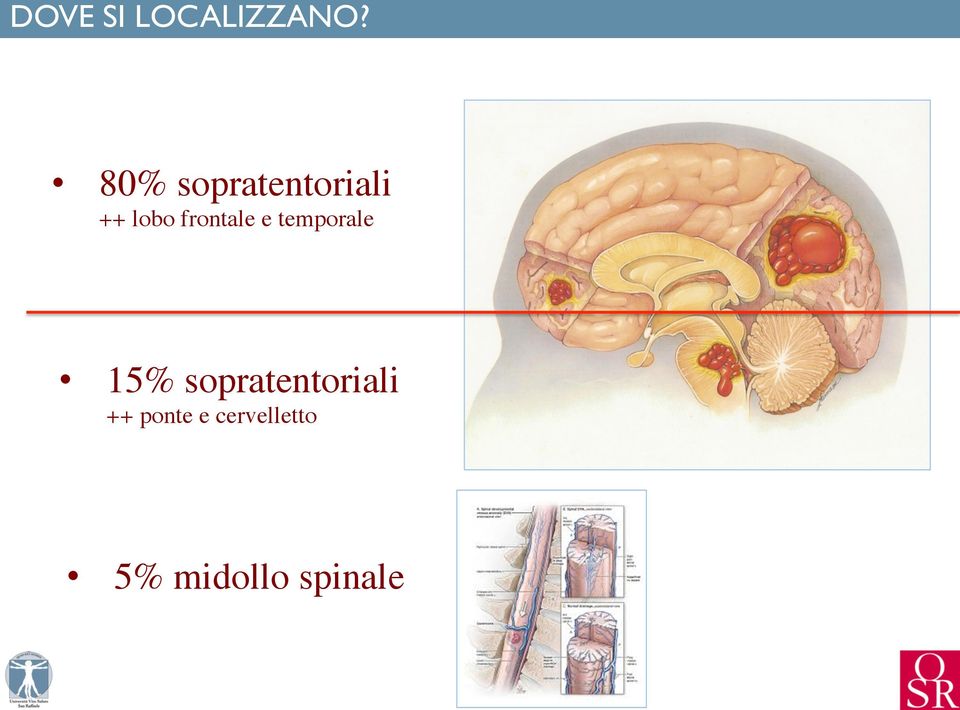 ++ lobo frontale e temporale 15%