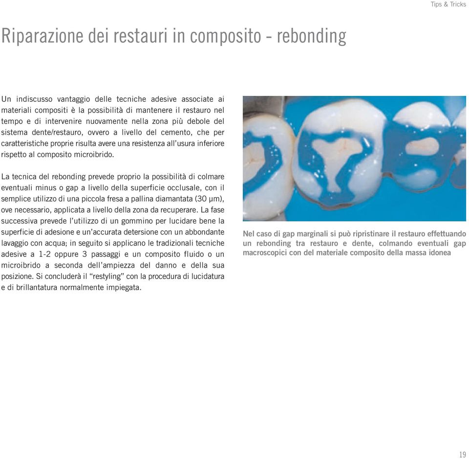 composito microibrido.