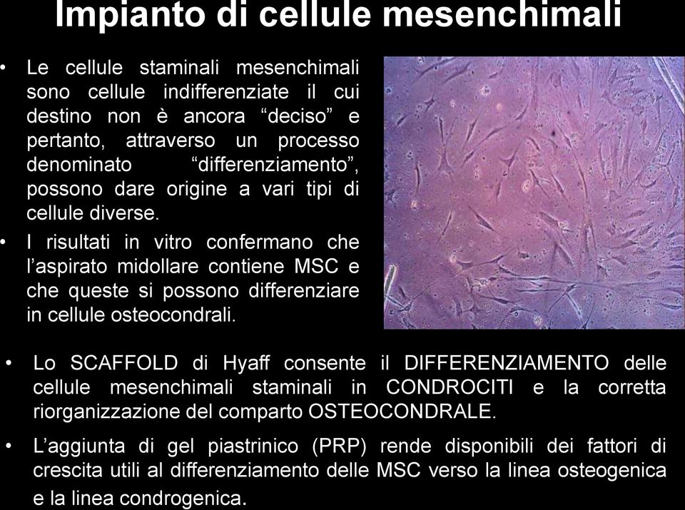 I risultati in vitro confermano che l aspirato midollare contiene MSC e che queste si possono differenziare in cellule osteocondrali.