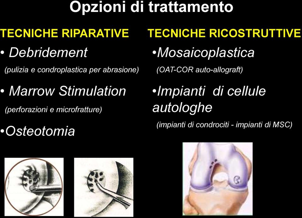 microfratture) Osteotomia TECNICHE RICOSTRUTTIVE Mosaicoplastica (OAT-COR