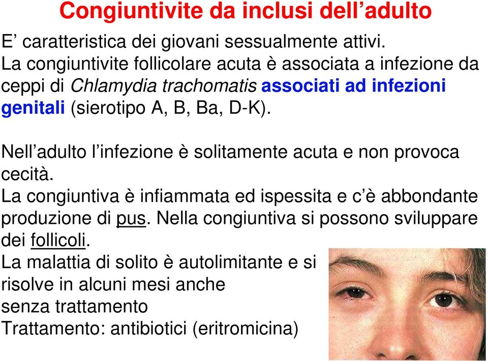 Ba, D-K). Nell adulto l infezione è solitamente acuta e non provoca cecità.