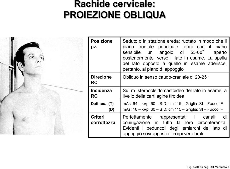 esame. La spalla del lato opposto a quello in esame aderisce, pertanto, al piano d appoggio Obliquo in senso caudo-craniale di 20-25 Sul m.