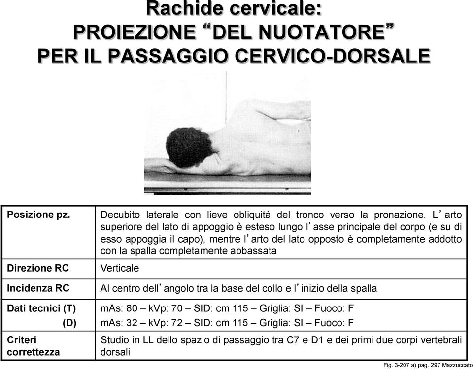 L arto superiore del lato di appoggio è esteso lungo l asse principale del corpo (e su di esso appoggia il capo), mentre l arto del lato opposto è completamente addotto con la