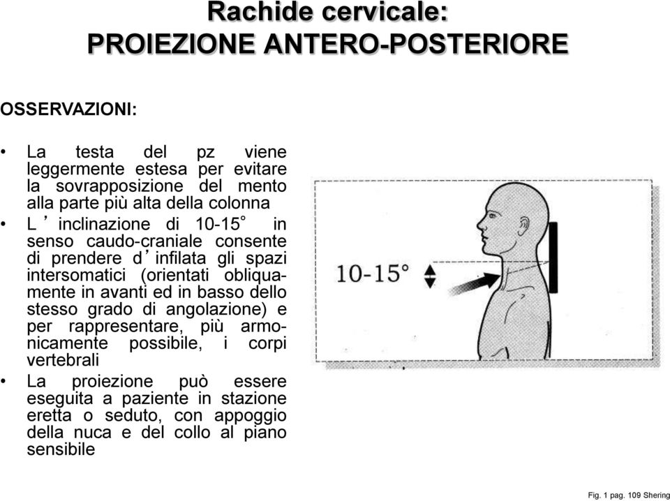 obliquamente in avanti ed in basso dello stesso grado di angolazione) e per rappresentare, più armonicamente possibile, i corpi vertebrali La