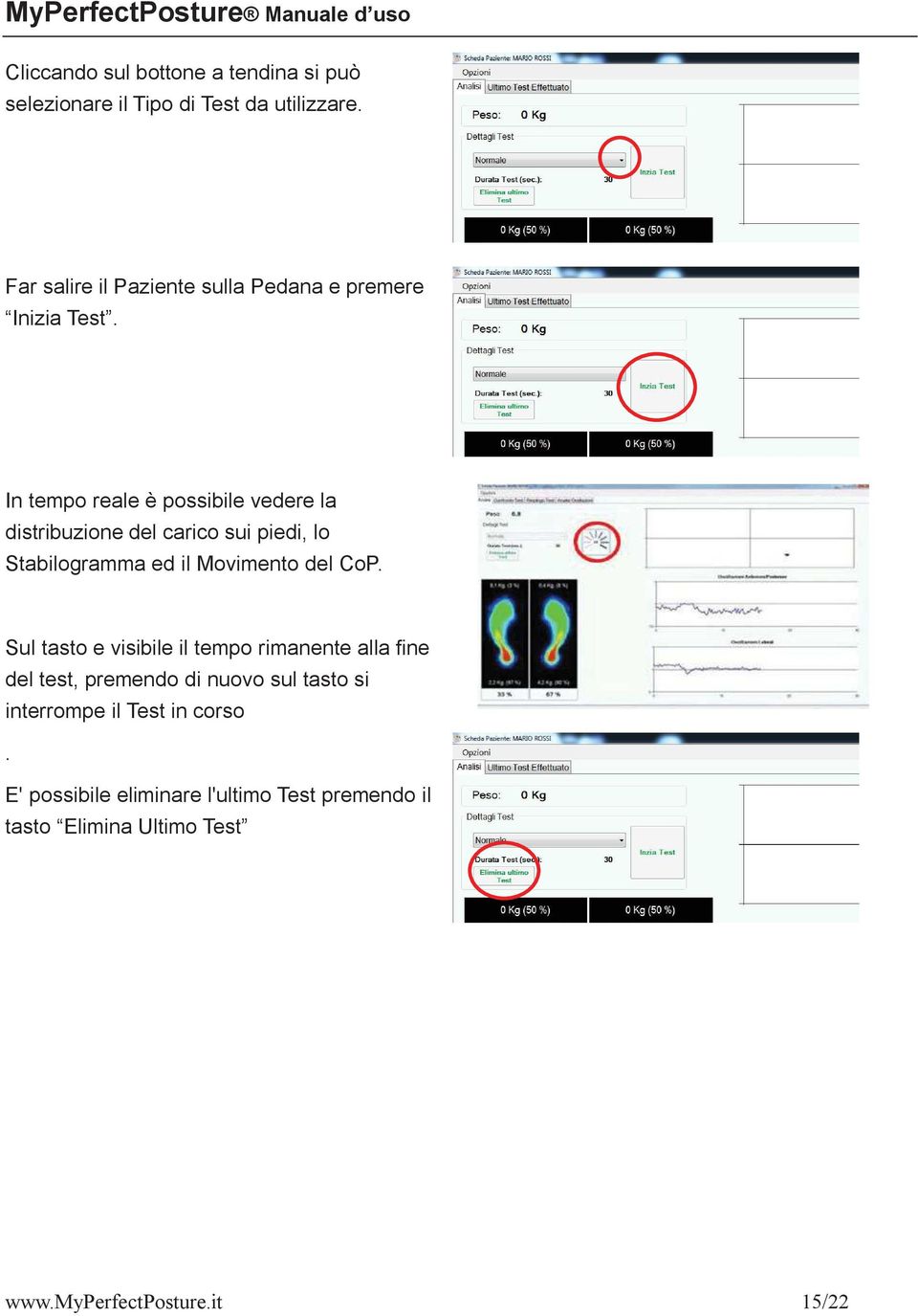 In tempo reale è possibile vedere la distribuzione del carico sui piedi, lo Stabilogramma ed il Movimento del CoP.