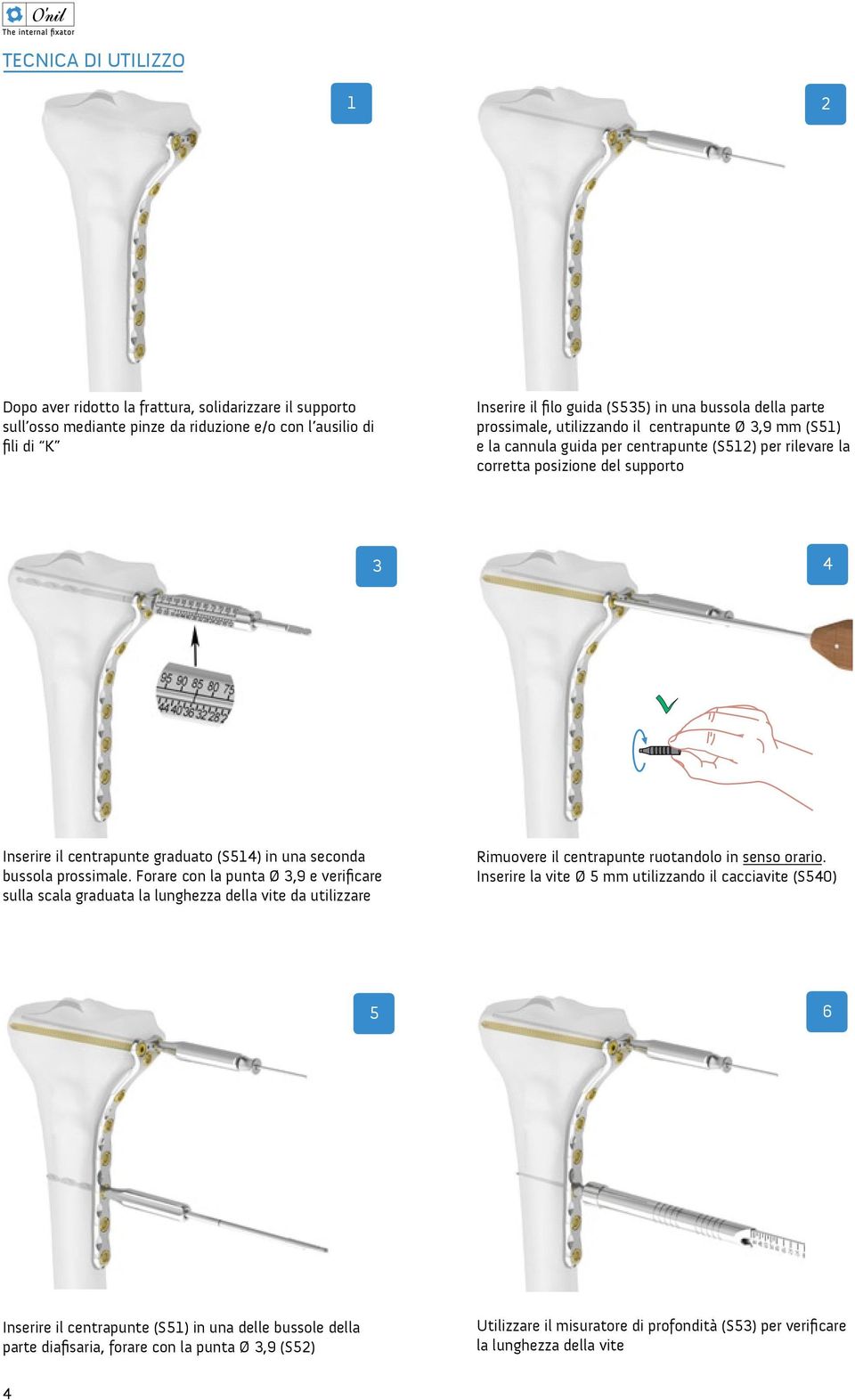 in una seconda bussola prossimale. Forare con la punta Ø 3,9 e verificare sulla scala graduata la lunghezza della vite da utilizzare Rimuovere il centrapunte ruotandolo in senso orario.