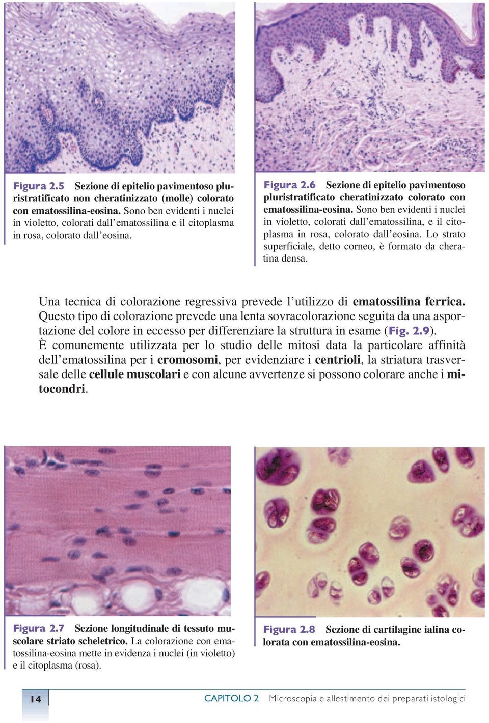 6 Sezione di epitelio pavimentoso pluristratificato cheratinizzato colorato con ematossilina-eosina.
