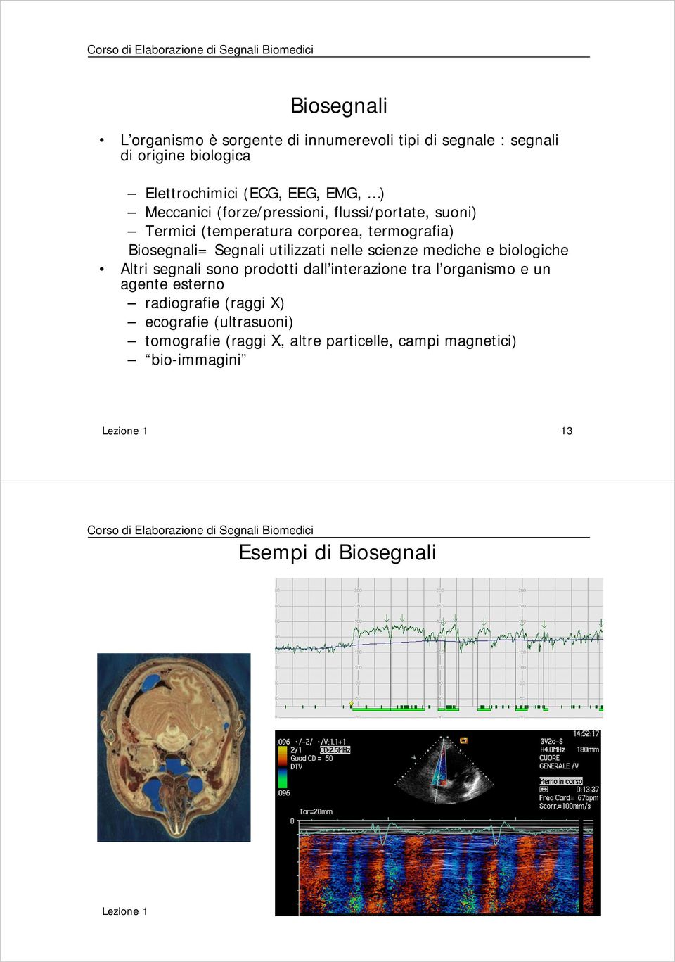 scienze mediche e biologiche Altri segnali sono prodotti dall interazione tra l organismo e un agente esterno radiografie (raggi X) ecografie (ultrasuoni)